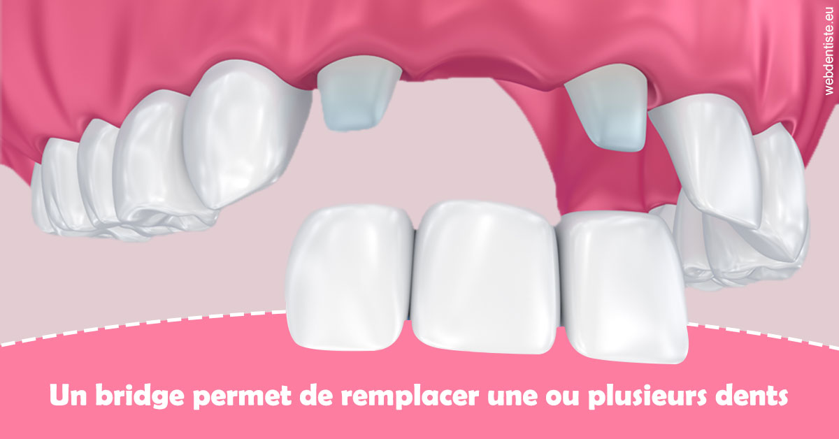 https://dr-claude-philippe.chirurgiens-dentistes.fr/Bridge remplacer dents 2