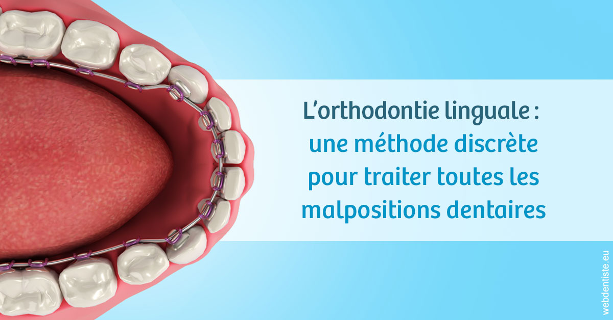 https://dr-claude-philippe.chirurgiens-dentistes.fr/L'orthodontie linguale 1