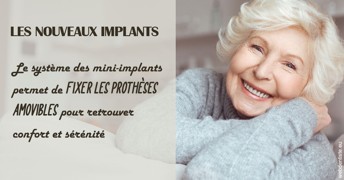 https://dr-claude-philippe.chirurgiens-dentistes.fr/Les nouveaux implants 1