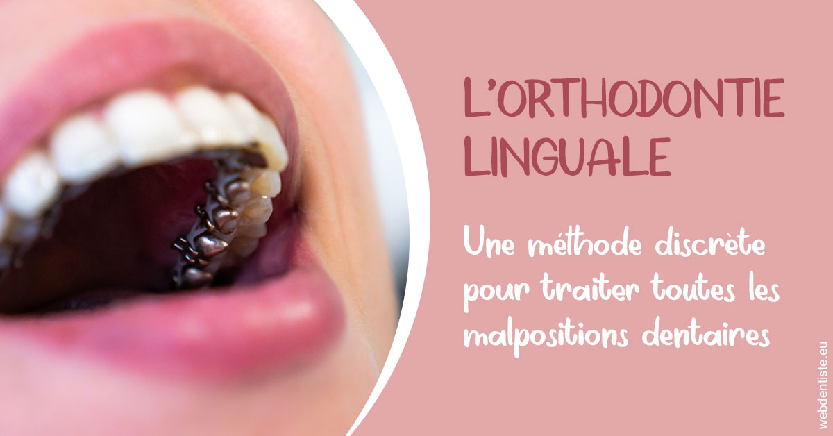 https://dr-claude-philippe.chirurgiens-dentistes.fr/L'orthodontie linguale 2