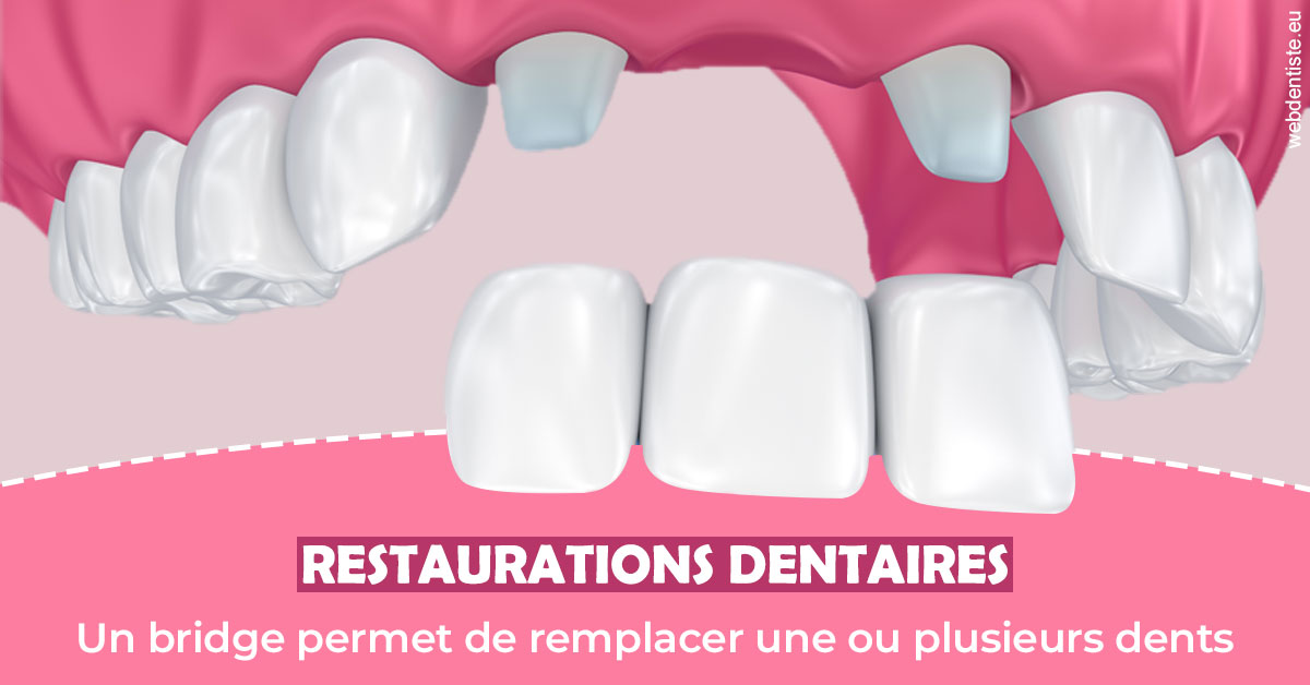 https://dr-claude-philippe.chirurgiens-dentistes.fr/Bridge remplacer dents 2
