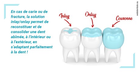 https://dr-claude-philippe.chirurgiens-dentistes.fr/L'INLAY ou l'ONLAY