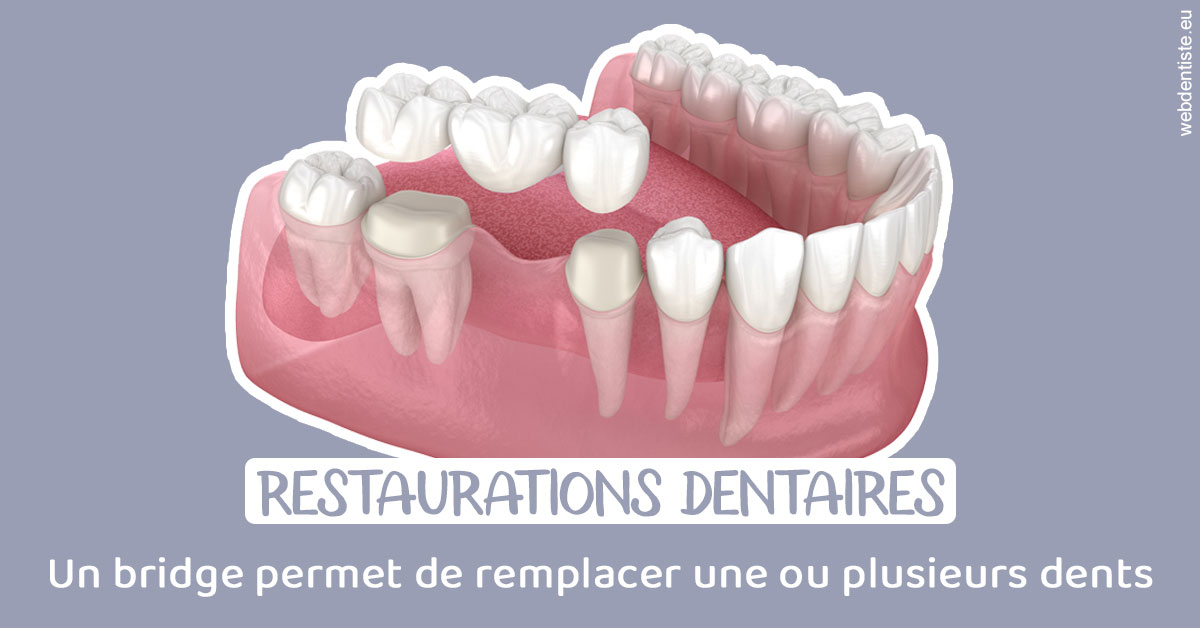 https://dr-claude-philippe.chirurgiens-dentistes.fr/Bridge remplacer dents 1
