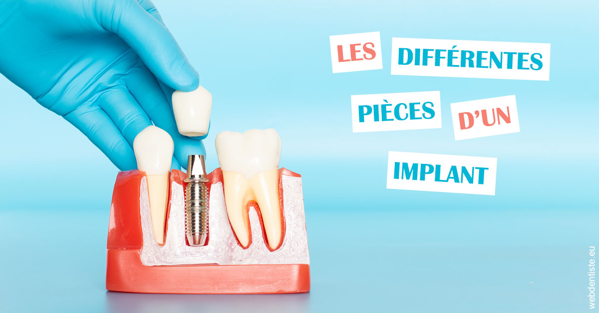 https://dr-claude-philippe.chirurgiens-dentistes.fr/Les différentes pièces d’un implant 2