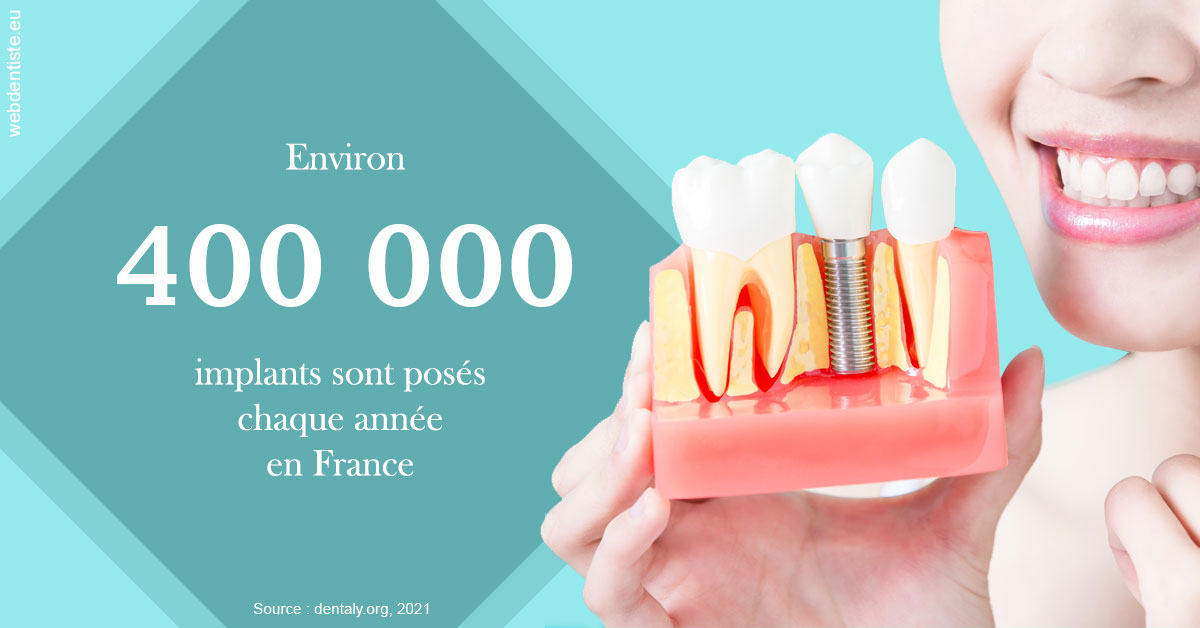 https://dr-claude-philippe.chirurgiens-dentistes.fr/Pose d'implants en France 2