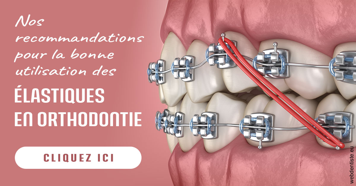 https://dr-claude-philippe.chirurgiens-dentistes.fr/Elastiques orthodontie 2
